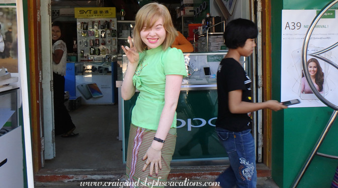 Young lady with albinism